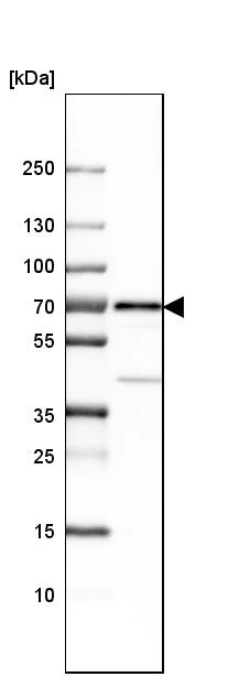 Western blot - Anti-LNK antibody (AB244278)