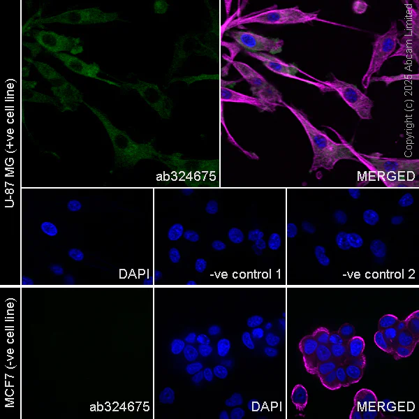 Immunocytochemistry/ Immunofluorescence - Anti-LNK antibody [EPR29362-561] (AB324675)