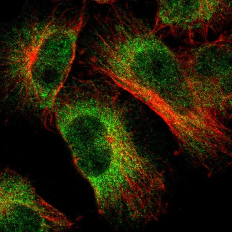 Immunocytochemistry/ Immunofluorescence - Anti-LNP antibody (AB121416)