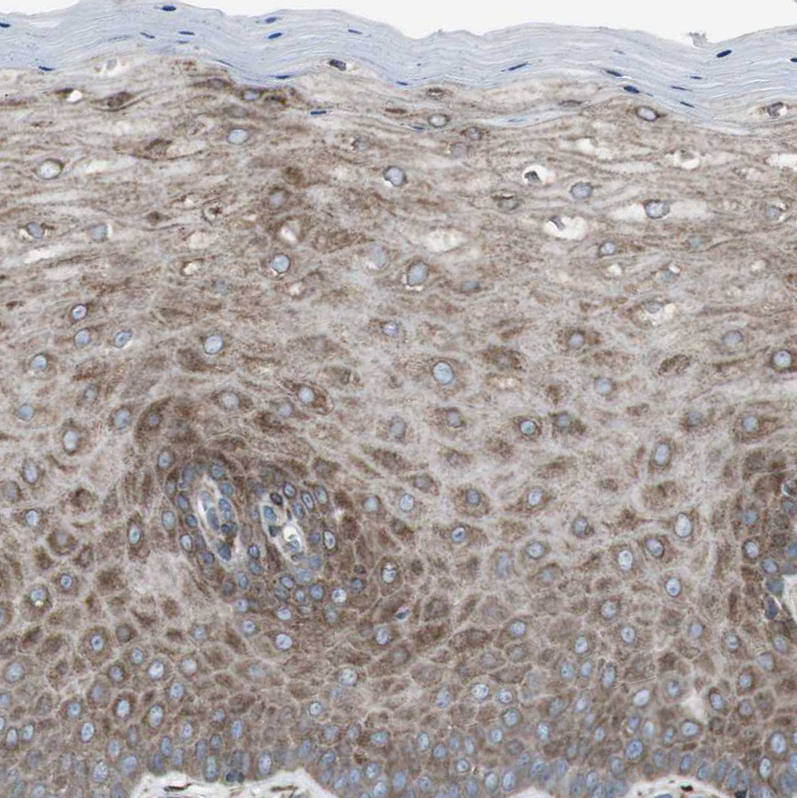 Immunohistochemistry (Formalin/PFA-fixed paraffin-embedded sections) - Anti-LNP antibody (AB121416), expandable thumbnail