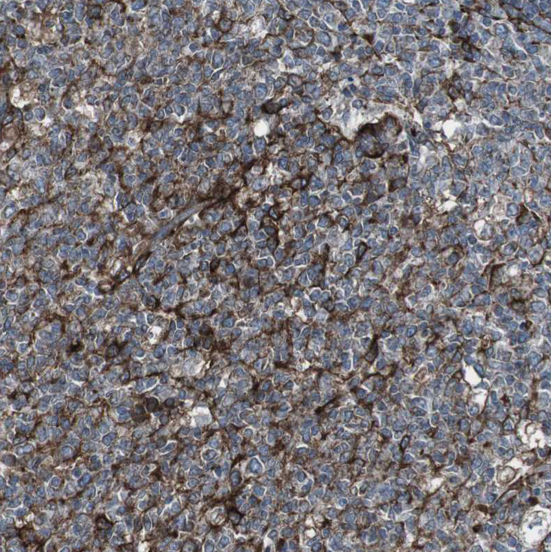 Immunohistochemistry (Formalin/PFA-fixed paraffin-embedded sections) - Anti-LNP antibody (AB121416), expandable thumbnail