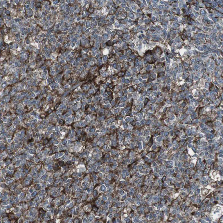 Immunohistochemistry (Formalin/PFA-fixed paraffin-embedded sections) - Anti-LNP antibody (AB121416)