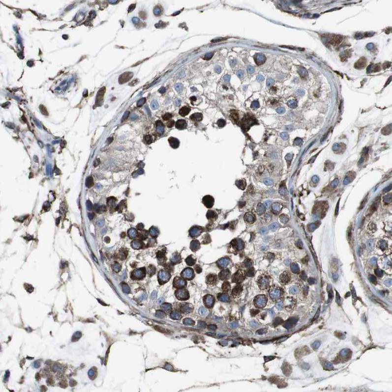 Immunohistochemistry (Formalin/PFA-fixed paraffin-embedded sections) - Anti-LNP antibody (AB121416), expandable thumbnail
