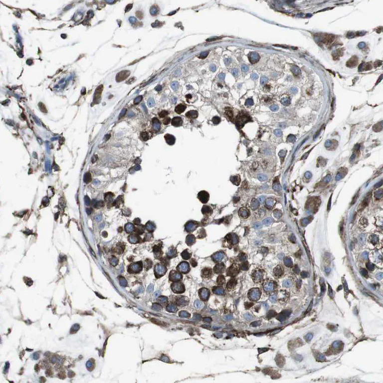 Immunohistochemistry (Formalin/PFA-fixed paraffin-embedded sections) - Anti-LNP antibody (AB121416)