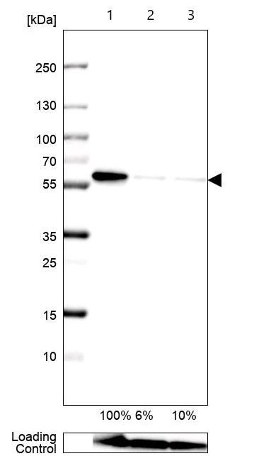 Western blot - Anti-LNP antibody (AB121416), expandable thumbnail