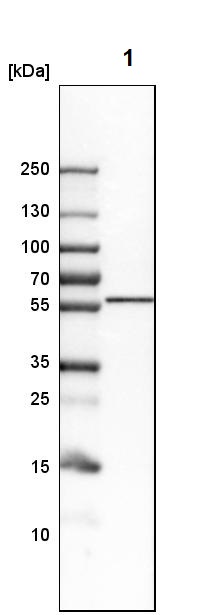 Western blot - Anti-LNP antibody (ab121416), expandable thumbnail