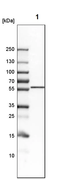 Western blot - Anti-LNP antibody (AB121416)