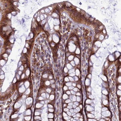 Immunohistochemistry (Formalin/PFA-fixed paraffin-embedded sections) - Anti-LNPEP antibody (AB244468)