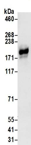 Immunoprecipitation - Anti-LNPEP antibody - N-terminal (AB190255), expandable thumbnail