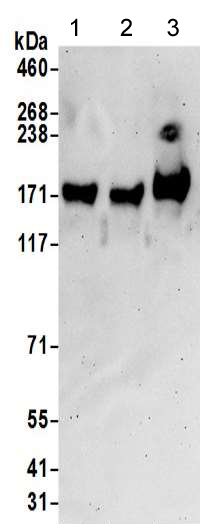 Western blot - Anti-LNPEP antibody - N-terminal (AB190255), expandable thumbnail