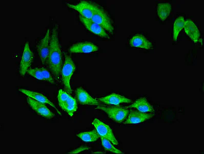 Immunocytochemistry/ Immunofluorescence - Anti-LOC134147/CMBL antibody (AB237694)