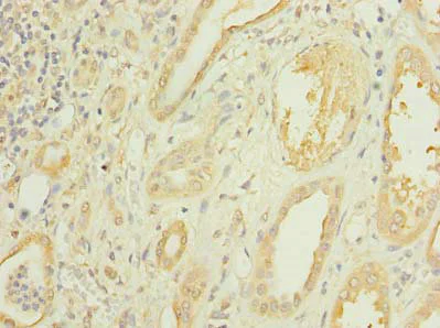 Immunohistochemistry (Formalin/PFA-fixed paraffin-embedded sections) - Anti-LOC134147/CMBL antibody (AB237694)