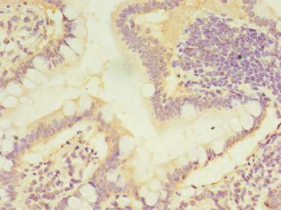 Immunohistochemistry (Formalin/PFA-fixed paraffin-embedded sections) - Anti-LOC134147/CMBL antibody (AB237694)