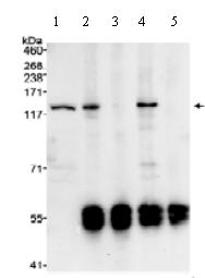Immunoprecipitation - Anti-LOK antibody (AB70484)