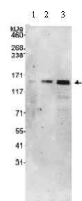 Western blot - Anti-LOK antibody (AB70484)