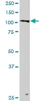 Western blot - Anti-LONP1/Lon antibody (AB103809)