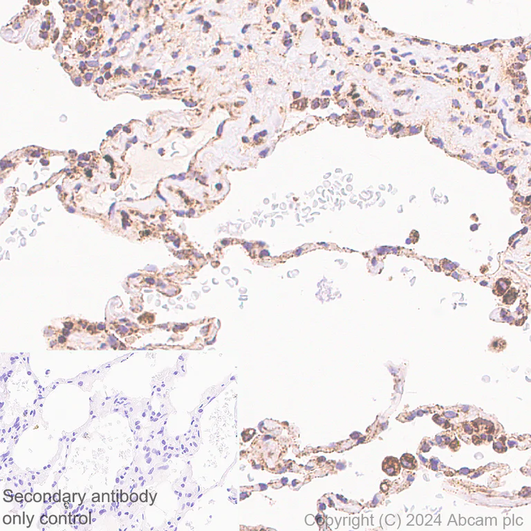 Immunohistochemistry (Formalin/PFA-fixed paraffin-embedded sections) - Anti-LONP1/Lon antibody [EPR28510-62] - BSA and Azide free (AB317562)