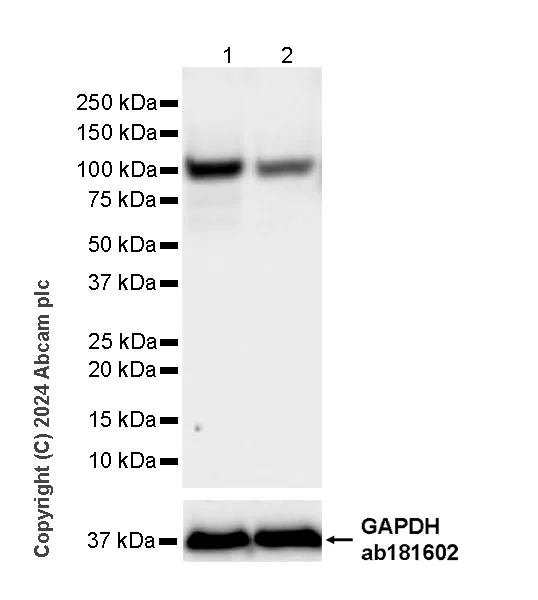 Western blot - Anti-LONP1/Lon antibody [EPR28510-62] - BSA and Azide free (AB317562)