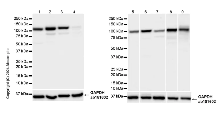 Western blot - Anti-LONP1/Lon antibody [EPR28510-62] - BSA and Azide free (AB317562)