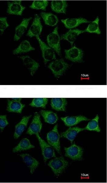 Immunocytochemistry/ Immunofluorescence - Anti-Loricrin antibody (AB137533), expandable thumbnail