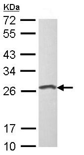 Western blot - Anti-Loricrin antibody (AB137533), expandable thumbnail