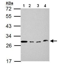 Western blot - Anti-Loricrin antibody (AB183646), expandable thumbnail