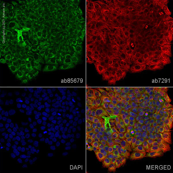 Immunocytochemistry - Anti-Loricrin antibody (AB85679)