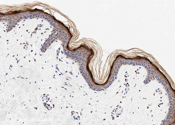 Immunohistochemistry (Formalin/PFA-fixed paraffin-embedded sections) - Anti-Loricrin antibody (AB85679)