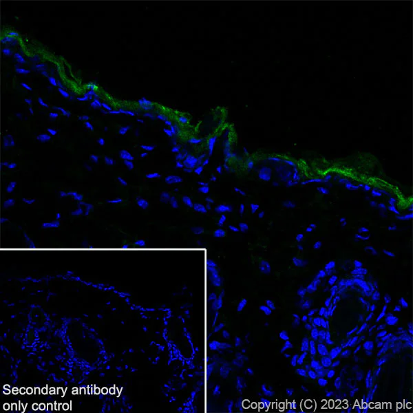 Immunohistochemistry (Frozen sections) - Anti-Loricrin antibody [EPR28296-23] (AB315806)