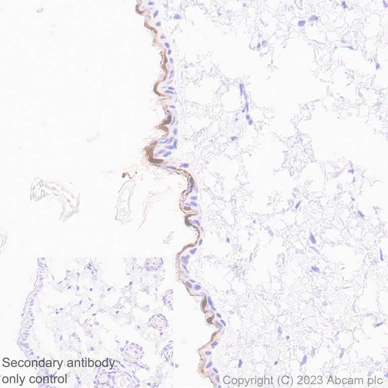 Immunohistochemistry (Formalin/PFA-fixed paraffin-embedded sections) - Anti-Loricrin antibody [EPR28296-23] - BSA and Azide free (AB315807)