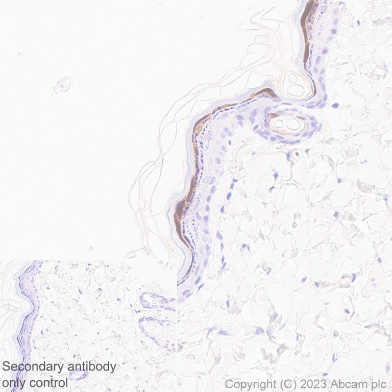 Immunohistochemistry (Formalin/PFA-fixed paraffin-embedded sections) - Anti-Loricrin antibody [EPR28296-23] - BSA and Azide free (AB315807)