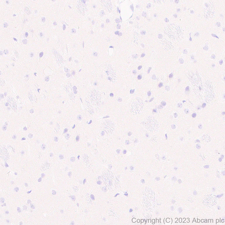 Immunohistochemistry (Formalin/PFA-fixed paraffin-embedded sections) - Anti-Loricrin antibody [EPR28296-23] - BSA and Azide free (AB315807)
