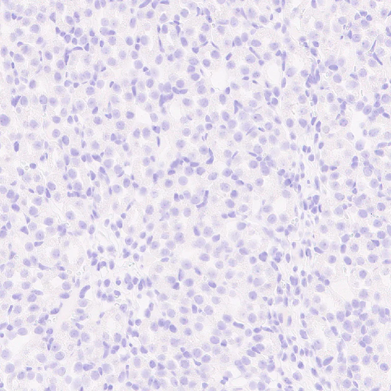 Immunohistochemistry (Formalin/PFA-fixed paraffin-embedded sections) - Anti-Loricrin antibody [EPR28296-23] - BSA and Azide free (AB315807)
