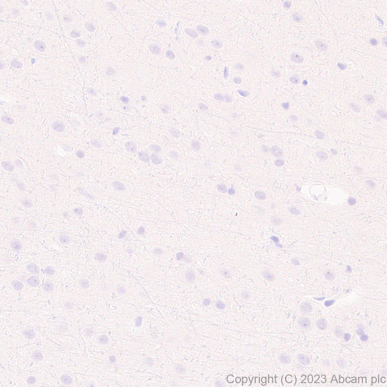 Immunohistochemistry (Formalin/PFA-fixed paraffin-embedded sections) - Anti-Loricrin antibody [EPR28296-23] - BSA and Azide free (AB315807)
