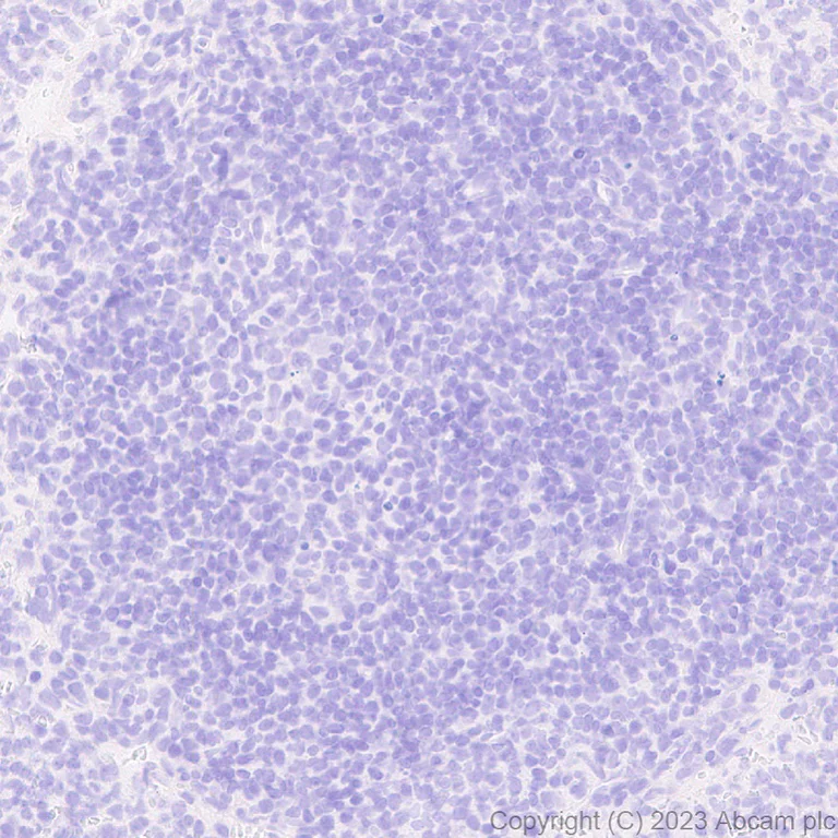 Immunohistochemistry (Formalin/PFA-fixed paraffin-embedded sections) - Anti-Loricrin antibody [EPR28296-23] - BSA and Azide free (AB315807)