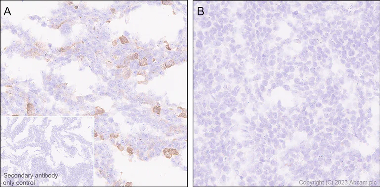 Immunohistochemistry (Formalin/PFA-fixed paraffin-embedded sections) - Anti-Loricrin antibody [EPR28296-23] - BSA and Azide free (AB315807)