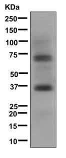 Western blot - Anti-Loricrin antibody [EPR7148(2)(B)] (AB176322)