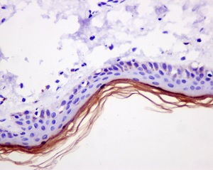 Immunohistochemistry (Formalin/PFA-fixed paraffin-embedded sections) - Anti-Loricrin antibody [EPR7148(2)(B)] - BSA and Azide free (AB240187), expandable thumbnail