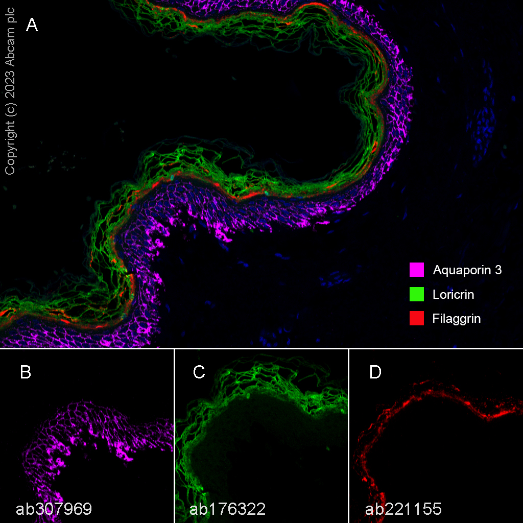 Multiplex immunohistochemistry - Anti-Loricrin antibody [EPR7148(2)(B)] - BSA and Azide free (AB240187), expandable thumbnail