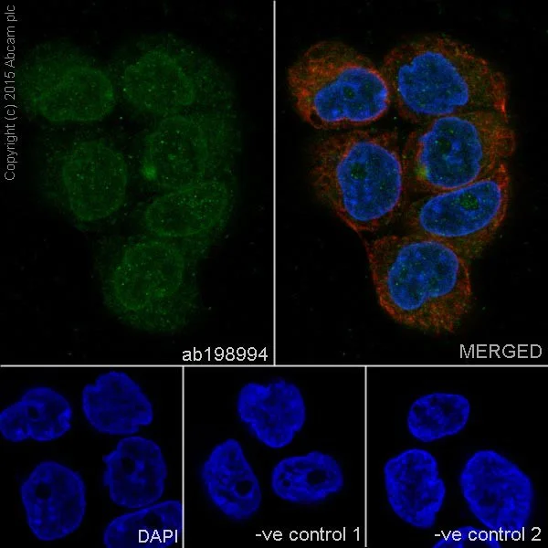 Immunocytochemistry/ Immunofluorescence - Anti-Loricrin antibody [EPR7149(2)] - BSA and Azide free (AB240345)