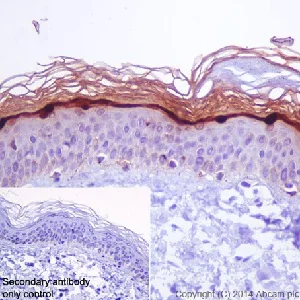 Immunohistochemistry (Formalin/PFA-fixed paraffin-embedded sections) - Anti-Loricrin antibody [EPR7149(2)] - BSA and Azide free (AB240345)