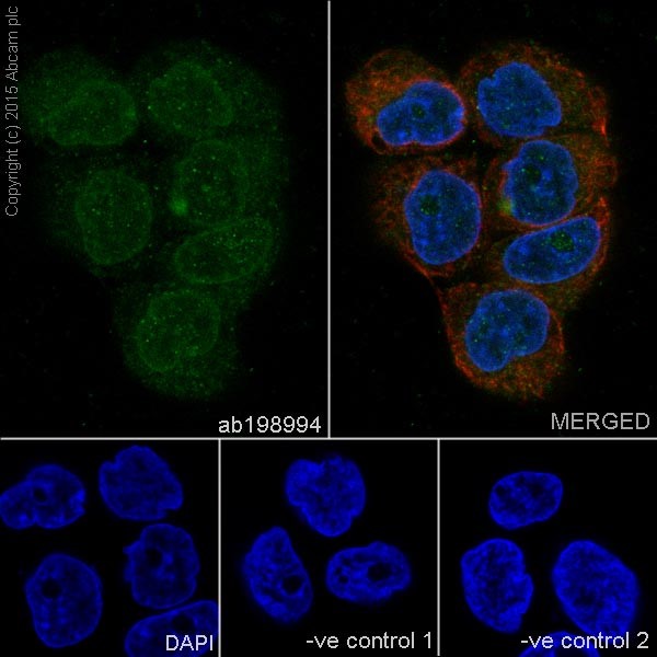 Immunocytochemistry/ Immunofluorescence - Anti-Loricrin antibody [EPR7149(2)] - C-terminal (AB198994), expandable thumbnail