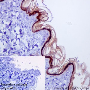 Immunohistochemistry (Formalin/PFA-fixed paraffin-embedded sections) - Anti-Loricrin antibody [EPR7149(2)] - C-terminal (AB198994), expandable thumbnail