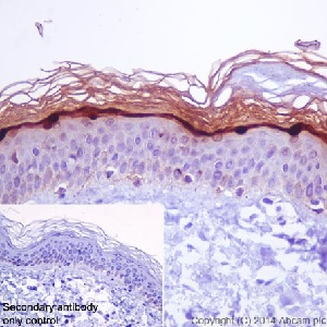 Immunohistochemistry (Formalin/PFA-fixed paraffin-embedded sections) - Anti-Loricrin antibody [EPR7149(2)] - C-terminal (AB198994), expandable thumbnail