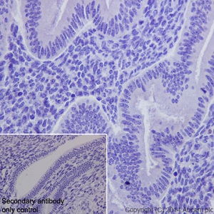 Immunohistochemistry (Formalin/PFA-fixed paraffin-embedded sections) - Anti-Loricrin antibody [EPR7149(2)] - C-terminal (AB198994), expandable thumbnail