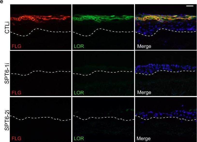 Immunohistochemistry - Anti-Loricrin antibody [EPR7149(2)] - C-terminal (AB198994)