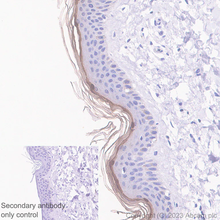 Immunohistochemistry (Formalin/PFA-fixed paraffin-embedded sections) - Anti-Loricrin antibody [RM1090] - BSA and Azide free (AB315353)