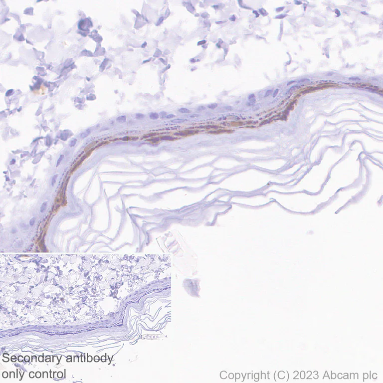 Immunohistochemistry (Formalin/PFA-fixed paraffin-embedded sections) - Anti-Loricrin antibody [RM1090] - BSA and Azide free (AB315353)