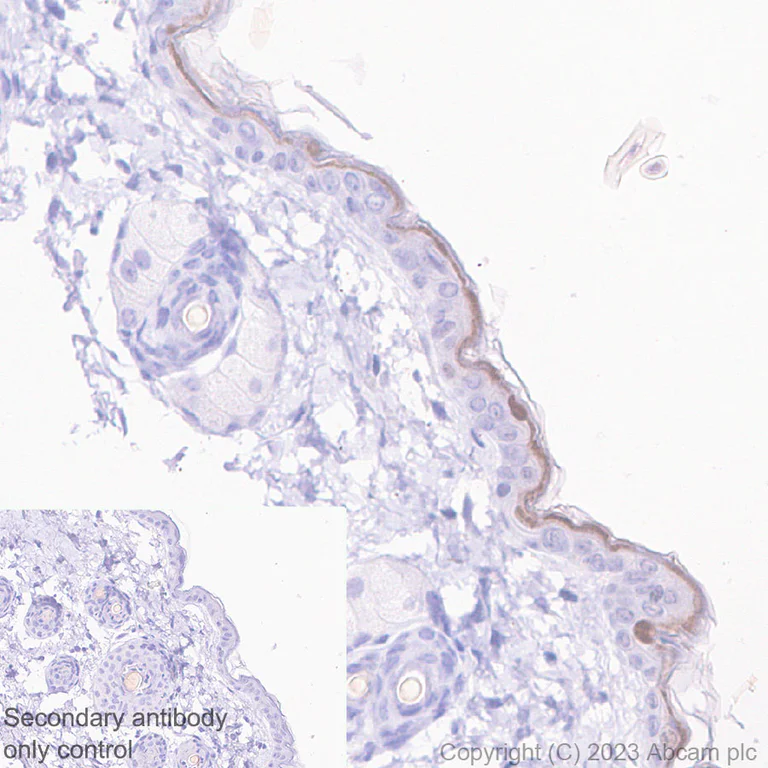 Immunohistochemistry (Formalin/PFA-fixed paraffin-embedded sections) - Anti-Loricrin antibody [RM1090] - BSA and Azide free (AB315353)