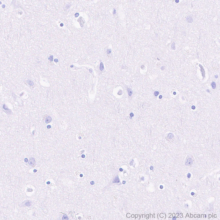 Immunohistochemistry (Formalin/PFA-fixed paraffin-embedded sections) - Anti-Loricrin antibody [RM1090] - BSA and Azide free (AB315353)